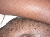 BoldGiggle-stick avatar