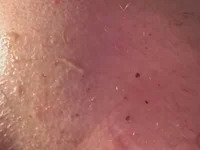 Explosiongape avatar