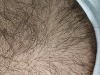 Hairykingh avatar