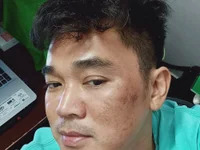 NguyenTrungHieu81 avatar