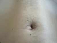 PoweredVitiligo avatar