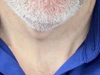 ThirstyBall0 avatar