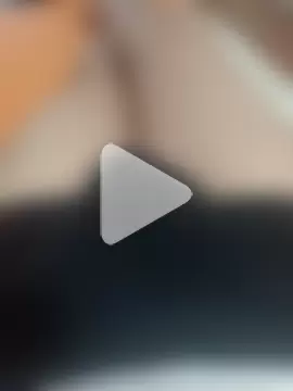 Anteplim272727 photo 19