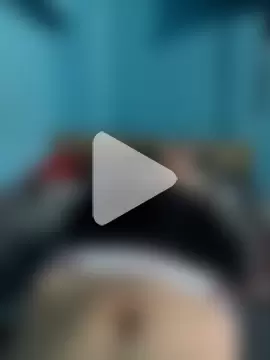 BlenchedSprain photo 26