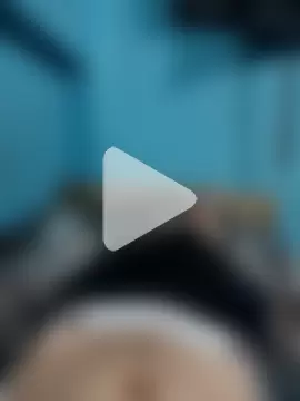 BlenchedSprain photo 25