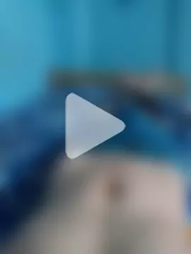 BlenchedSprain photo 22