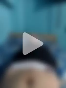 BlenchedSprain photo 21