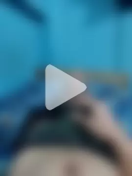 BlenchedSprain photo 11