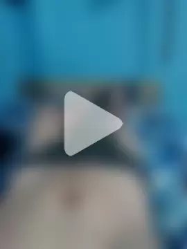 BlenchedSprain photo 8