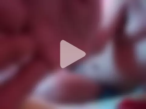 Cachinhospreto photo 15