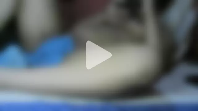 Cachinhospreto photo 12