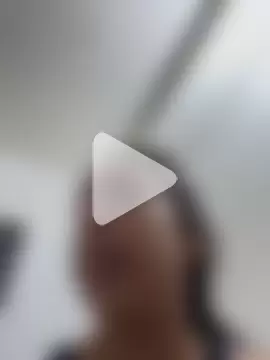 Heratemporal photo 6