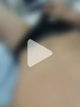 Piroocudinho photo 1