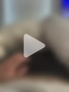 hairypokeballs photo 1