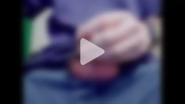 hairyuncut00 photo 20