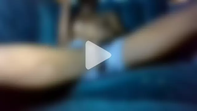 philippiano33 photo 24