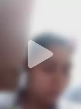 yesi-nursehot photo 28